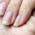 What are the best beauty and health tips for avoiding brittle nails?