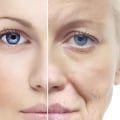 What is anti-aging therapy?