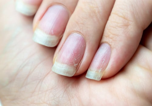 What are the best beauty and health tips for avoiding brittle nails?