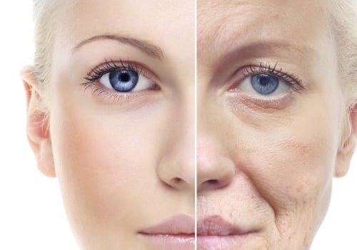 What is anti-aging therapy?